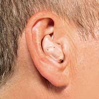 In the Ear (ITE) Hearing Aid