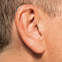 Open Fit Hearing Aid Options