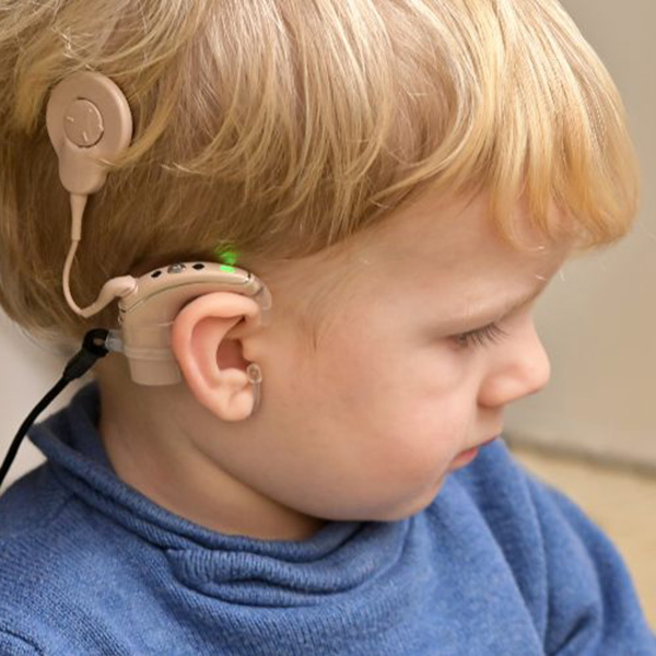 Sensorineural Hearing Loss in Naples & Estero, FL